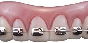 A model of a mouth with Billy Bob Fool-All Braces on it.