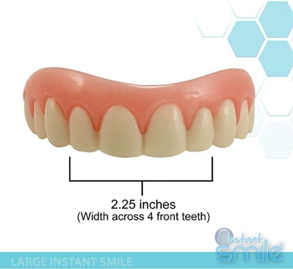 A model of Instant Smile - Large Size Handmade Veneer - Original - Fix Your Smile in just Minutes!.